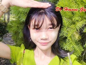 ပါးကွက်ကြားနဲ့အငုံးလေး