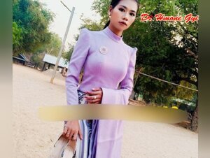 မျက်နှာပေါ်အပန်းခံရတဲ့ရခိုင်သူ